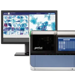The new Genius system next to a computer screen showing cell images on a white background
