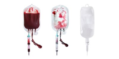 Photo of a blood bag of red blood cells for blood transfusion isolated on a white background.