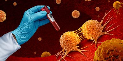 A gloved hand holds a blood vacutainer against a background of cancer cells dividing.