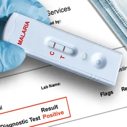 A gloved hand holds a malaria-positive test result taken on a rapid diagnostic testing device with a printed lab report form in the background.