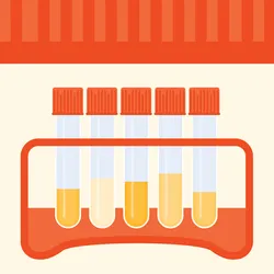 Illustration of a urine sample test tube rack in a clinical laboratory.