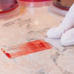 Photo of a medical laboratory scientist wearing gloves preparing a blood smear test on a glass slide.