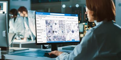 Photo of a lab professional using Techcyte's clinical pathology platform.