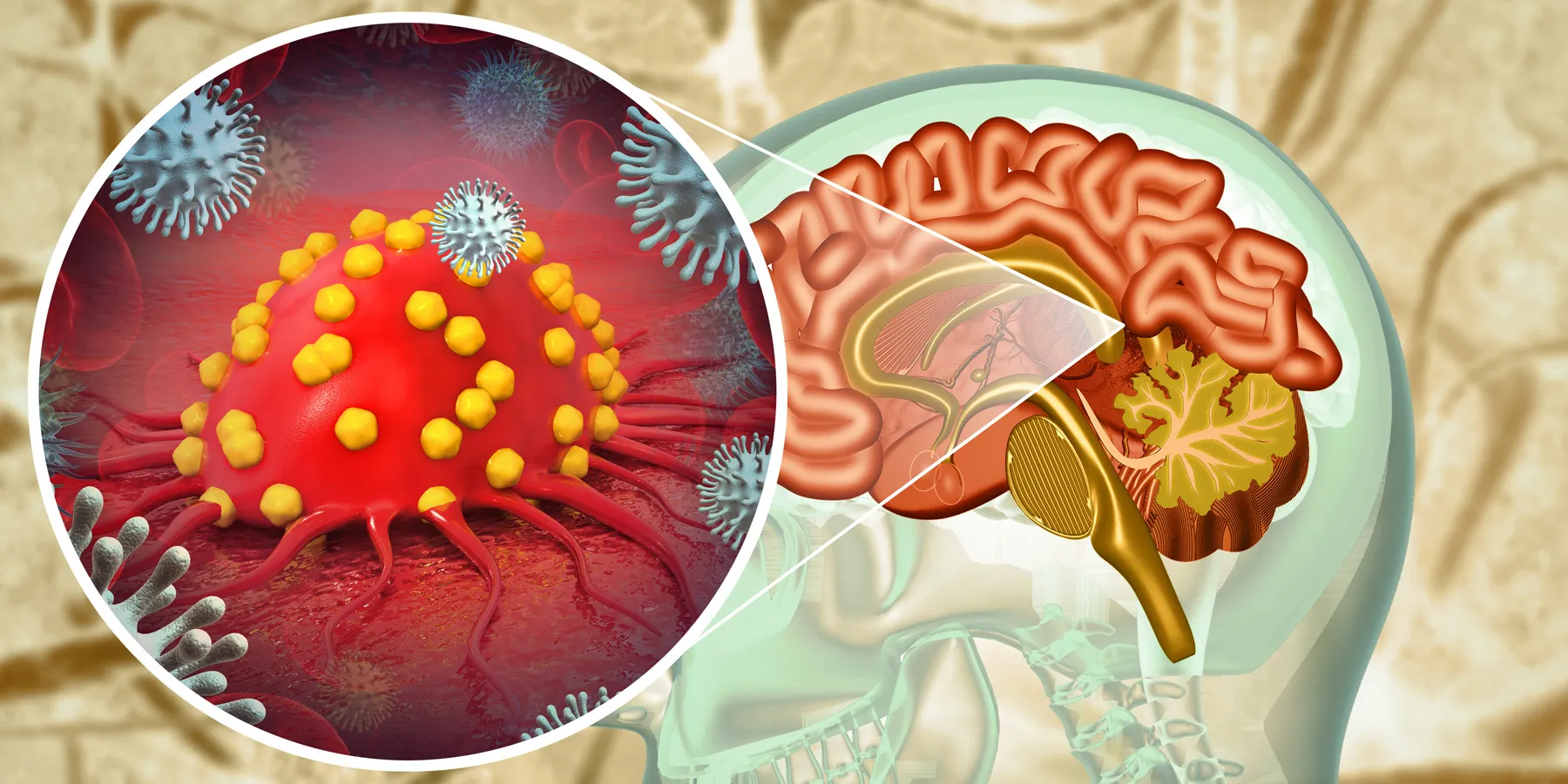 3D illustration of brain tumor being attacked by immune cells against a background of a human brain in a head X-ray image.