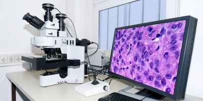 A microscope and a monitor constitute a digital imaging system. 