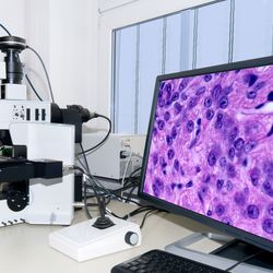 A microscope and a monitor constitute a digital imaging system. 