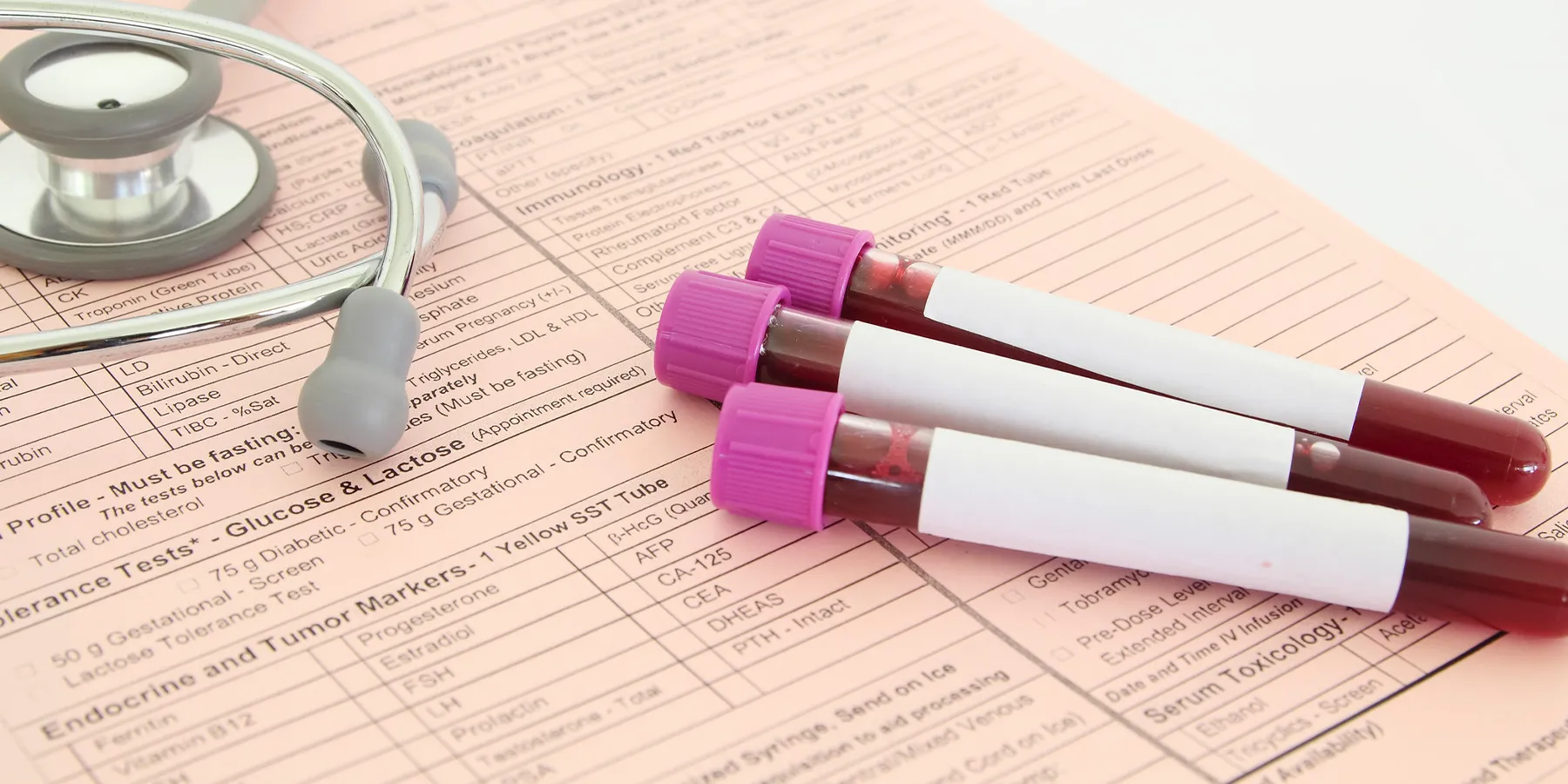 Monocyte Count Predicts Lung Disease Risk in COVID19 Patients