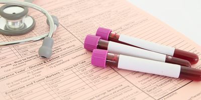 Three yet-to-be-labeled blood vacutainers are placed on a test order form with a stethoscope on the side.