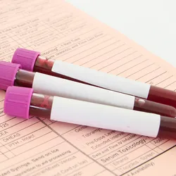 Three yet-to-be-labeled blood vacutainers are placed on a test order form with a stethoscope on the side.