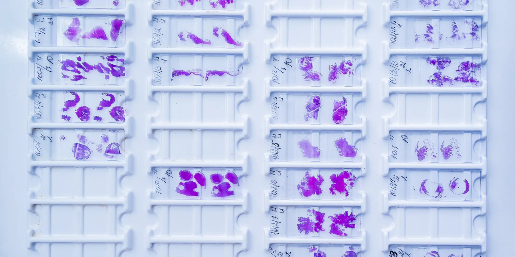 A collection of pathology slides containing stained tissues.