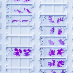 A collection of pathology slides containing stained tissues.