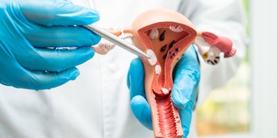 A clinician with gloved hands points with a pen to a model of the female reproductive system with tumors in the uterine wall.