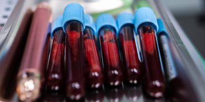 Vacutainers filled with collected blood samples are ready to be analyzed.