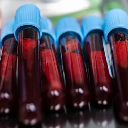 Vacutainers filled with collected blood samples are ready to be analyzed.