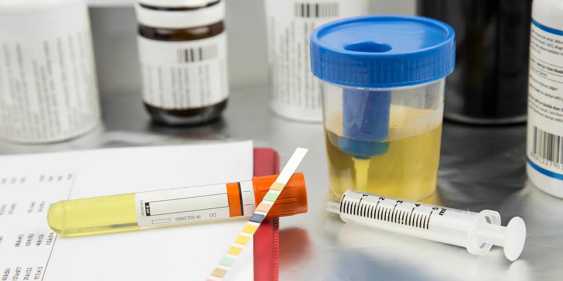 A urine sample in a container is kept on a lab bench for analysis with a pH strip, syringe, vacutainer, and requisition form around it.