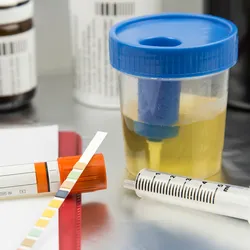 A urine sample in a container is kept on a lab bench for analysis with a pH strip, syringe, vacutainer, and requisition form around it.