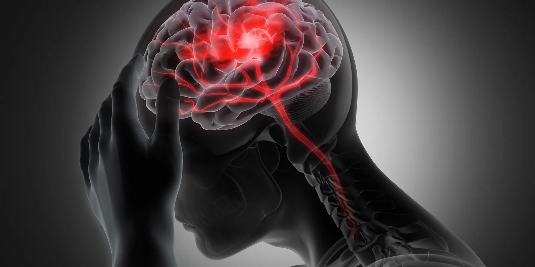 Graphic illustration of a person holding their head with the brain and nerves are highlighted to indicate pain or headache.