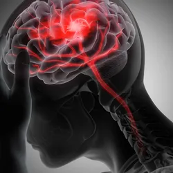 Graphic illustration of a person holding their head with the brain and nerves are highlighted to indicate pain or headache.