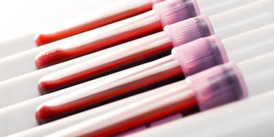 A series of blood collection tubes on a rocker in a lab.