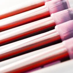 A series of blood collection tubes on a rocker in a lab.