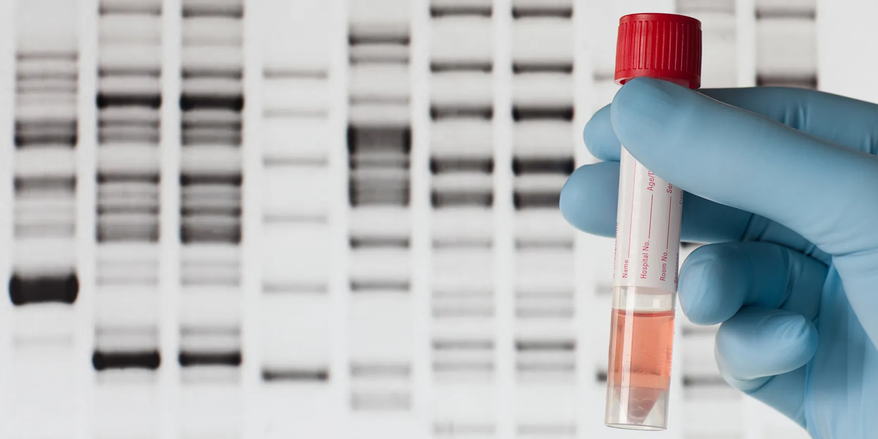 Photo of a laboratory professional holding up a test tube in front of a DNA electrophoresis gel of a genetic test for markers of gestational diabetes.