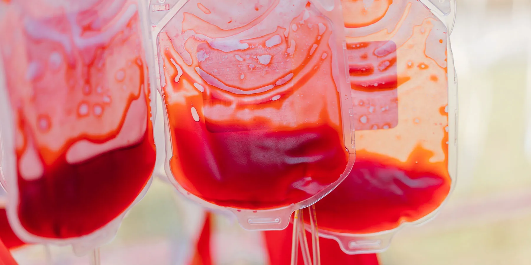 Close-up photo of three half-empty blood bags hanging from a stand used for the blood transfusion process.