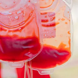 Close-up photo of three half-empty blood bags hanging from a stand used for the blood transfusion process.