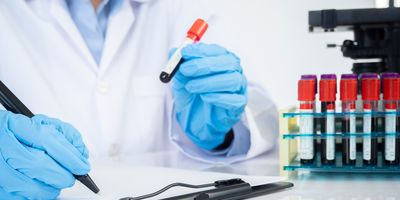 Lab workers holding a blood test vial and writing results