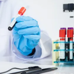 Lab workers holding a blood test vial and writing results