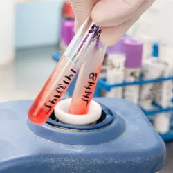 Clinical laboratory scientist loading prepping a patient sample for a clinical flow cytometry experiment.