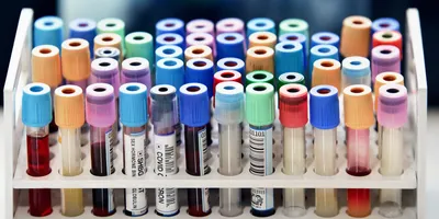 A tray of lab samples