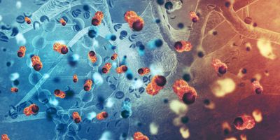 Artist’s rendering of cancer cells in the human body.