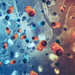 Artist’s rendering of cancer cells in the human body.