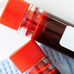 Up-close photo of blood test tubes with barcode labels on a clinical laboratory bench.