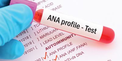 Photo of a blood sample in a test tube for ANA testing in clinical laboratory.