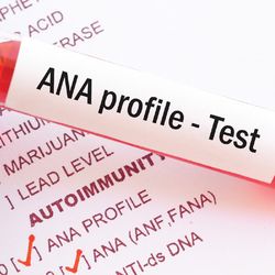 Photo of a blood sample in a test tube for ANA testing in clinical laboratory.