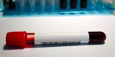 Photo of a test tube filled with blood lying on a clinical lab bench.