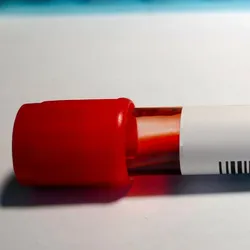Photo of a test tube filled with blood lying on a clinical lab bench.