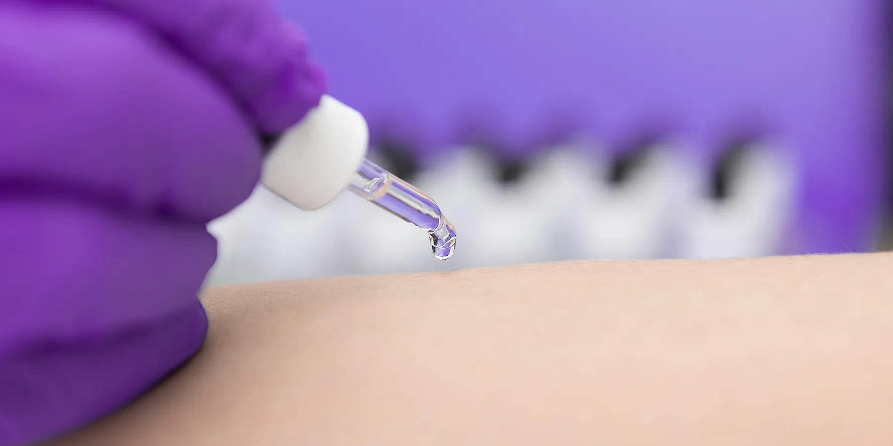 Photo of a clinical laboratory technician wearing purple gloves administering a skin test for PFAS from a dropper. 