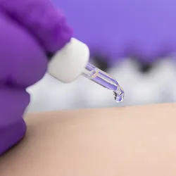 Photo of a clinical laboratory technician wearing purple gloves administering a skin test for PFAS from a dropper.