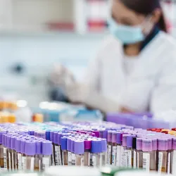 Photo of two medical laboratory professionals wearing PPE in a clinical lab processing blood sample tubes.