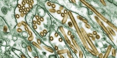 Digitally-colorized transmission electron microscopic image of Avian Influenza A H5N1 virus particles (seen in gold), grown in Madin-Darby Canine Kidney (MDCK) epithelial cells (seen in green).