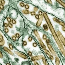 Digitally-colorized transmission electron microscopic image of Avian Influenza A H5N1 virus particles (seen in gold), grown in Madin-Darby Canine Kidney (MDCK) epithelial cells (seen in green).