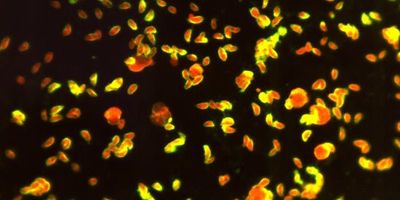 Under a magnification of 570X, this photomicrograph of a fluorescent antibody (FA)-stained specimen, revealed numerous, Toxoplasma sp. tachyzoites, which was interpreted as a positive IFA reaction for antibodies to T. gondii. In this case, the yellow-colored fluorescence does extend around the entire periphery of each organism, and is not just concentrated at the organisms’ anterior end, as would be the case in polar staining.