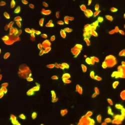 Under a magnification of 570X, this photomicrograph of a fluorescent antibody (FA)-stained specimen, revealed numerous, Toxoplasma sp. tachyzoites, which was interpreted as a positive IFA reaction for antibodies to T. gondii. In this case, the yellow-colored fluorescence does extend around the entire periphery of each organism, and is not just concentrated at the organisms’ anterior end, as would be the case in polar staining.