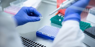 Photo of a clinical laboratory professional wearing PPE holding a pipette in the lab and working on RNA samples from pregnant people at risk of preeclampsia.