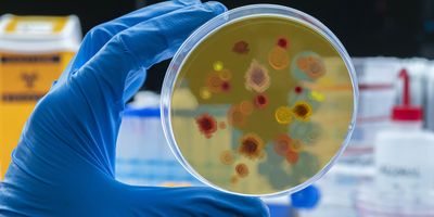 Photo of Candida auris on a culture plate in a clinical laboratory.