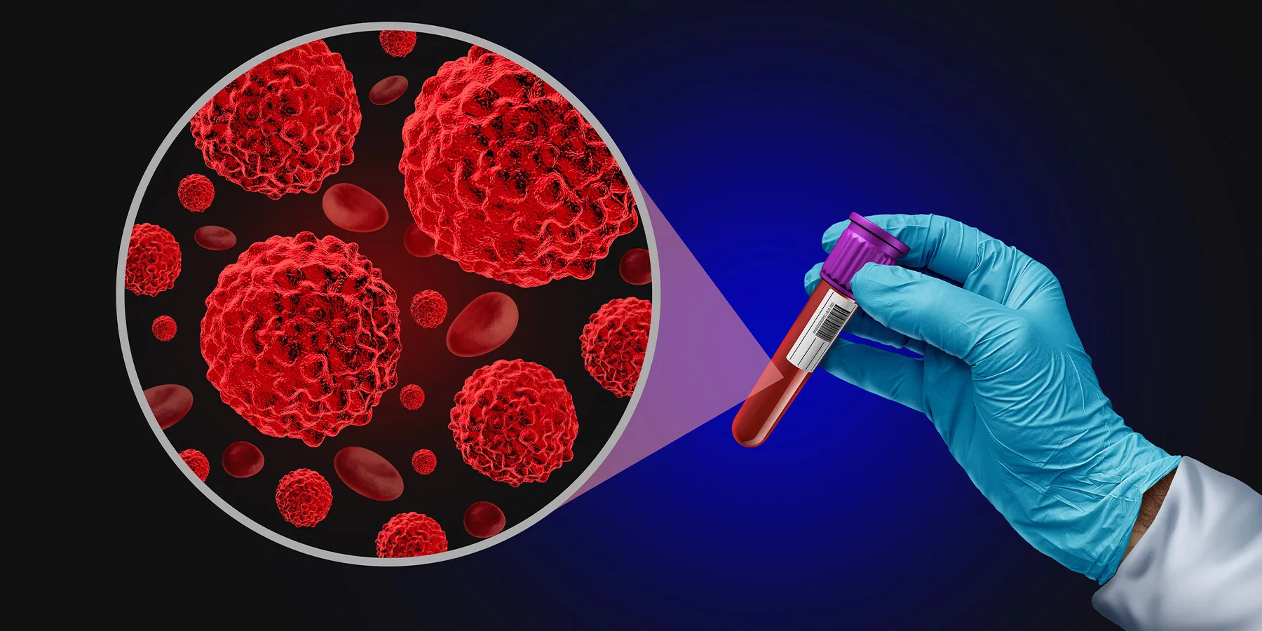 Illustration of a clinical lab scientist wearing gloves and holding a tube of blood with a zoom-in on blood antibodies for syphilis.