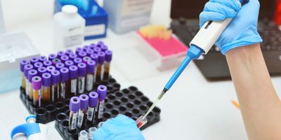 photo of a clinical laboratory professional holding a pipette and dispensing a blood tube sample in a medical lab.