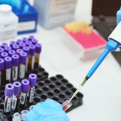 photo of a clinical laboratory professional holding a pipette and dispensing a blood tube sample in a medical lab.